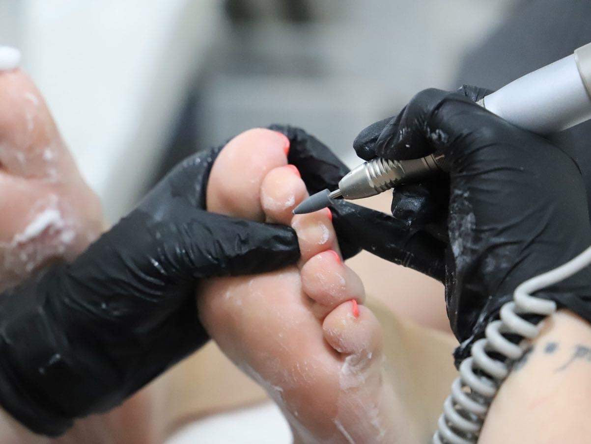 Advance pedicure
