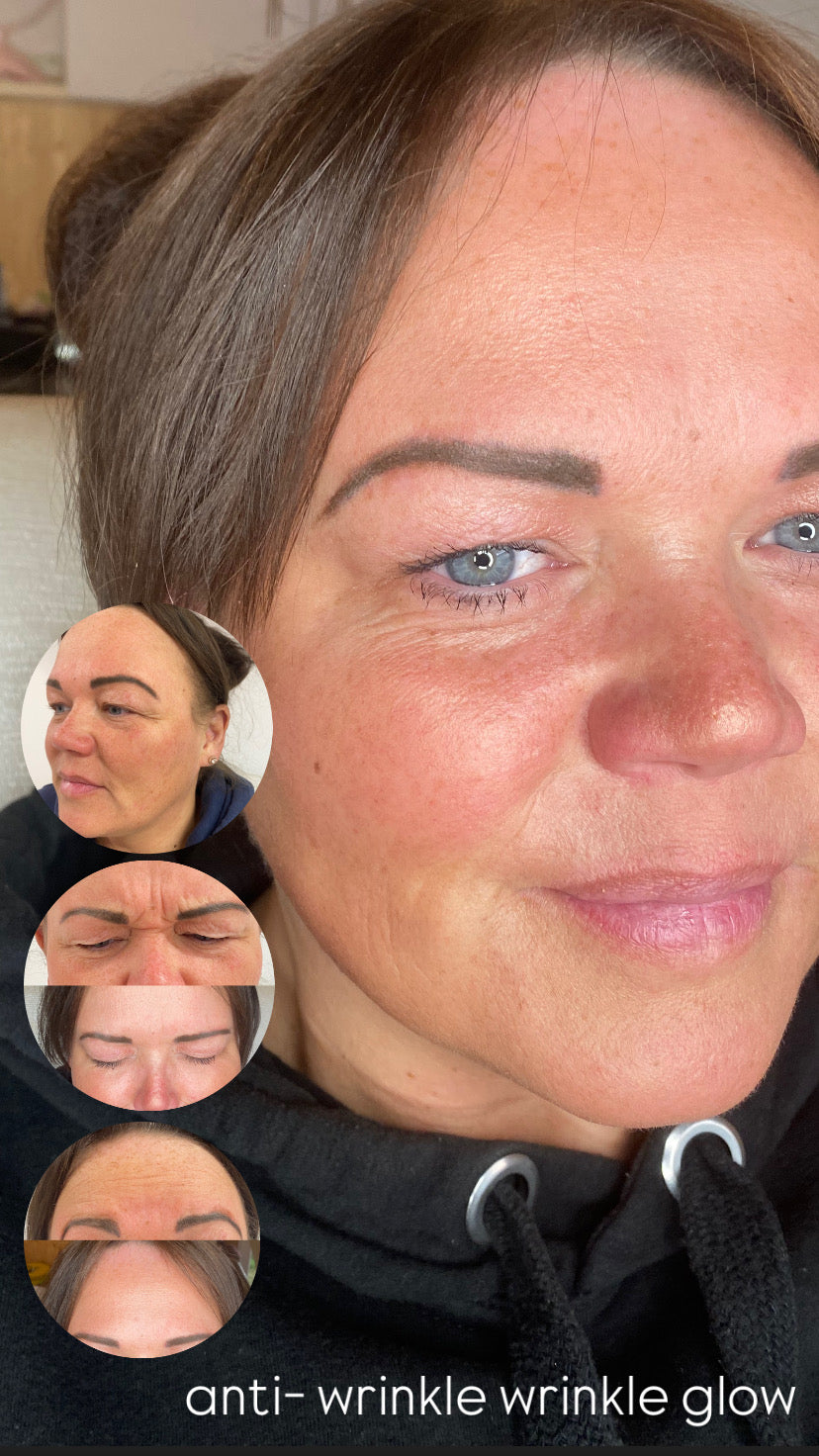 Anti Wrinkle Treatment's